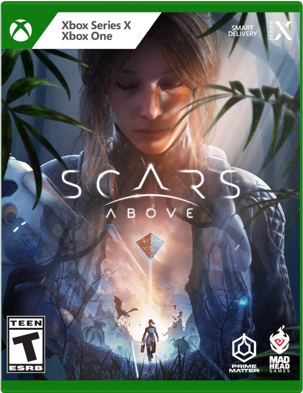 Xbox Series X|S